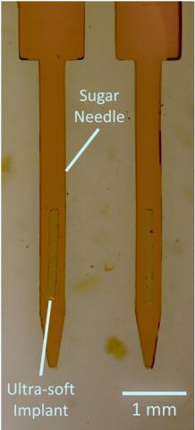  L'aiguille en sucre permet d'acheminer l'implant au site cible puis se dissout en quelques secondes, libérant ainsi l’implant en silicone (Visuel The Neuro)