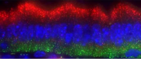 La muqueuse diffère de chaque côté (vert et rouge) au niveau cellulaire (en bleu) dans la composition de l'ARN messager