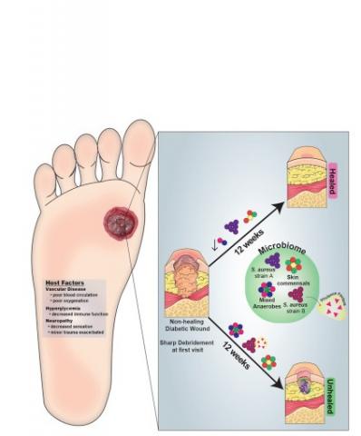 A. Faecalis semble stimuler une inflammation bénéfique de la peau lésée qui limite les effets néfastes de bactéries plus nocives.