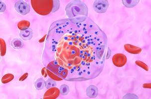 La dexaméthasone, hormone de stress synthétique, pourrait réduire les métastases du cancer du sein (Visuel Adobe Stock 1031587846) La dexaméthasone, hormone de stress synthétique, pourrait réduire les métastases du cancer du sein (Visuel Adobe Stock 1031587846)