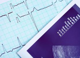 La suppression de l'expression de l'ACE2 pendant l'infection par le SRAS-CoV est impliquée dans la sévérité de la pneumonie et l’insuffisance pulmonaire aiguë observées avec ce virus.