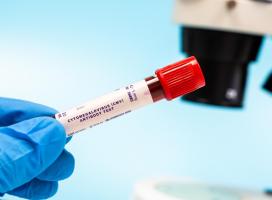 La recherche décrypte un mécanisme jusqu'alors méconnu par lequel le CMV qui infecte la majorité de la population adulte mondiale, pénètre dans les cellules qui tapissent les vaisseaux sanguins et contribue aux maladies vasculaires (Visuel Adobe Stock 1224533109) La recherche décrypte un mécanisme jusqu'alors méconnu par lequel le CMV qui infecte la majorité de la population adulte mondiale, pénètre dans les cellules qui tapissent les vaisseaux sanguins et contribue aux maladies vasculaires (Visuel Adobe Stock 1224533109)