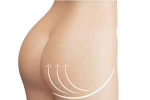 Le remodelage des fesses est ainsi au nombre des procédures esthétiques les plus plébiscitées et connait, cette dernière année, une progression de 10% en nombre d’interventions. Le remodelage des fesses est ainsi au nombre des procédures esthétiques les plus plébiscitées et connait, cette dernière année, une progression de 10% en nombre d’interventions.