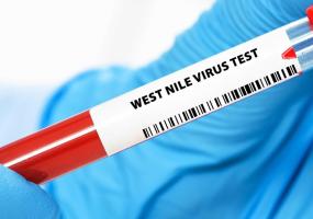 Cette équipe sensibilise et apporte de premières recommandations, dans l'objectif de pouvoir mieux détecter, prévenir, et prendre en charge la maladie (Visuel Adobe Stock 1599953667) Cette équipe sensibilise et apporte de premières recommandations, dans l'objectif de pouvoir mieux détecter, prévenir, et prendre en charge la maladie (Visuel Adobe Stock 1599953667)