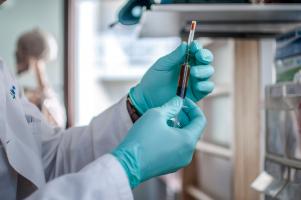 La perte du chromosome Y dans les cellules sanguines provoque une insuffisance cardiaque et le décès par maladie cardiovasculaire (Visuel Adobe Stock 171229859) La perte du chromosome Y dans les cellules sanguines provoque une insuffisance cardiaque et le décès par maladie cardiovasculaire (Visuel Adobe Stock 171229859)