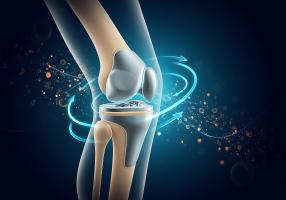 3 études mettent en vant les avantages de l’ostéointégration pour les personnes amputées (Visuel Adobe Stock 1899570321)