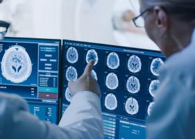 Des changements de forme du cerveau constituent des signes avant-coureurs de démence (Visuel Adobe Stock 236237463) Des changements de forme du cerveau constituent des signes avant-coureurs de démence (Visuel Adobe Stock 236237463)