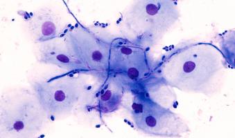 En décryptant ce processus dans la relation complexe entre les humains et les champignons du microbiote, cette étude désigne de nouvelles cibles qui pourraient aider à lutter contre l’émergence croissante d'agents pathogènes résistants aux médicaments (Visuel Adobe Stock 275831019)