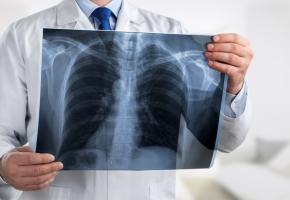 L'analyse annuelle d'images informatisée, notamment via l’IA, pourrait offrir un moyen plus précoce et plus objectif d'identifier les patients présentant un risque élevé d'aggravation de la maladie (Visuel Adobe Stock 276455512).