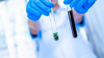 L'utilisation de THC pendant la grossesse induit des changements épigénétiques qui impactent le développement du fœtus (Visuel Adobestock 282032586) L'utilisation de THC pendant la grossesse induit des changements épigénétiques qui impactent le développement du fœtus (Visuel Adobestock 282032586)