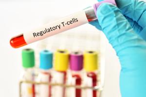 Utiliser la force du cancer pour le combattre, c’est la toute nouvelle technique qui pourrait révolutionner l'immunothérapie du cancer (Visuel Adobe stock 290536652) Utiliser la force du cancer pour le combattre, c’est la toute nouvelle technique qui pourrait révolutionner l'immunothérapie du cancer (Visuel Adobe stock 290536652)