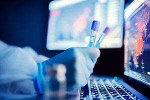 Quels sont les vaccins sûrs et efficaces pour le rappel (ou 3è injection) après les 2 doses de vaccin à ARNm (Pfizer/BioNTech et Moderna) ? (Visuel Adobe Stock 321710772) Quels sont les vaccins sûrs et efficaces pour le rappel (ou 3è injection) après les 2 doses de vaccin à ARNm (Pfizer/BioNTech et Moderna) ? (Visuel Adobe Stock 321710772)