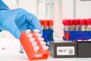 Les outils que les scientifiques utilisent aujourd'hui pour étudier comment le SRAS-CoV-2 se transmet et évolue n'ont pas été conçus pour de tels volumes de données (Visuel Adobe Stock 335755911)