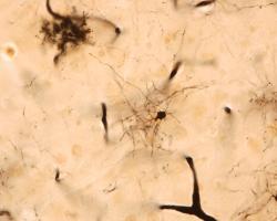 Une molécule, appelée fractalkine, présente dans le cerveau, aide à «réveiller» les cellules cérébrales productrices de myéline, ce qui est prometteur pour le traitement de certains troubles neurodégénératifs (Visuel Adobe Stock 398867984) Une molécule, appelée fractalkine, présente dans le cerveau, aide à «réveiller» les cellules cérébrales productrices de myéline, ce qui est prometteur pour le traitement de certains troubles neurodégénératifs (Visuel Adobe Stock 398867984)