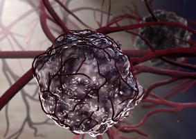 Les métastases accèdent au système circulatoire non seulement par l'excroissance de nouvelles branches de vaisseaux sanguins, mais aussi par un processus alternatif, par lequel un vaisseau sanguin se divise en 2 vaisseaux parallèles (Visuel Adobe Stock 41995222) Les métastases accèdent au système circulatoire non seulement par l'excroissance de nouvelles branches de vaisseaux sanguins, mais aussi par un processus alternatif, par lequel un vaisseau sanguin se divise en 2 vaisseaux parallèles (Visuel Adobe Stock 41995222).