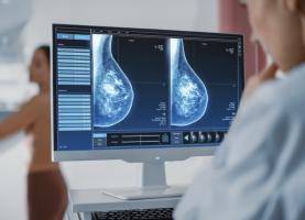 Les femmes qui manquent leur première mammographie présentent un risque accru de décès par cancer du sein (Visuel Adobe Stock 422714239) Les femmes qui manquent leur première mammographie présentent un risque accru de décès par cancer du sein (Visuel Adobe Stock 422714239)