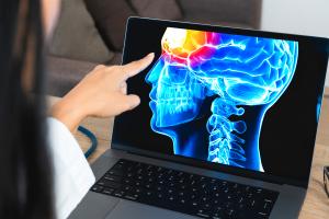 Les femmes migraineuses encourent un risque encore élargi, avec également une augmentation de l’incidence de la crise cardiaque et de l’AVC hémorragique (Visuel Adobe Stock 521036904) Les femmes migraineuses encourent un risque encore élargi, avec également une augmentation de l’incidence de la crise cardiaque et de l’AVC hémorragique (Visuel Adobe Stock 521036904)