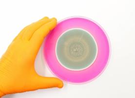 La recherche décrypte la dualité du rôle bien particulier de la levure Candida albicans (C. albicans) et plus précisément de sa toxine, dans la colonisation du tube digestif (Visuel Adobe Stock 612964810) La recherche décrypte la dualité du rôle bien particulier de la levure Candida albicans (C. albicans) et plus précisément de sa toxine, dans la colonisation du tube digestif (Visuel Adobe Stock 612964810)