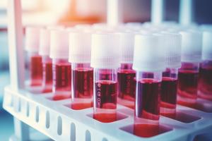 Les personnes qui sont sous traitement antirétroviral (TARV) et qui présentent de faibles niveaux de charge virale -même détectables- n'ont pratiquement aucun risque de transmettre sexuellement le virus à d'autres personnes (Visuel Adobe Stock 656634784) Les personnes qui sont sous traitement antirétroviral (TARV) et qui présentent de faibles niveaux de charge virale -même détectables- n'ont pratiquement aucun risque de transmettre sexuellement le virus à d'autres personnes (Visuel Adobe Stock 656634784)