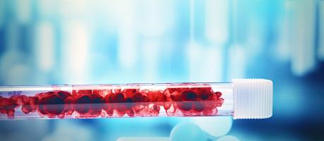 L'étude décrypte le rôle clé d’une protéine de la coagulation sanguine dans la perte de neurones après un traumatisme crânien majeur (Visuel Adobe Stock 692292375) L'étude décrypte le rôle clé d’une protéine de la coagulation sanguine dans la perte de neurones après un traumatisme crânien majeur (Visuel Adobe Stock 692292375)