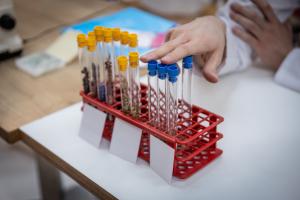 Le rôle des polyphénols dans la prévention et le traitement des maladies est aujourd’hui si puissant que ces antioxydants ont leur congrès (Visuel Adobe Stock 792069616) Le rôle des polyphénols dans la prévention et le traitement des maladies est aujourd’hui si puissant que ces antioxydants ont leur congrès (Visuel Adobe Stock 792069616)