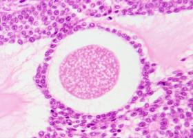 Cet ovaroïde va permettre une meilleure compréhension et le développement de nouveaux traitements pour les anomalies ou différences de développement sexuel (DDS) et l'infertilité (Visuel Adobe Stock 826191555).