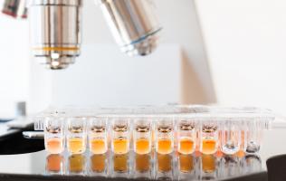 Certains champignons intestinaux se développent dans les cas les plus sévères et amplifient l'inflammation excessive tout en entraînant des changements durables dans le système immunitaire.(Visuel Adobe stock 85264757) Certains champignons intestinaux se développent dans les cas les plus sévères et amplifient l'inflammation excessive tout en entraînant des changements durables dans le système immunitaire.(Visuel Adobe stock 85264757)