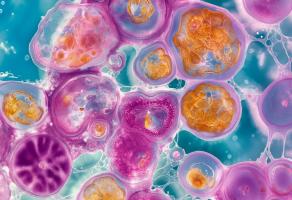 C’est la découverte d’une protéine clé dans la régulation des cellules souches musculaires (Visuel Adobe Stock 882299305)