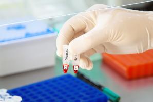 Certains groupes sanguins pourraient être associés à une plus forte susceptibilité au nouveau coronavirus SARS-CoV-2. Certains groupes sanguins pourraient être associés à une plus forte susceptibilité au nouveau coronavirus SARS-CoV-2.