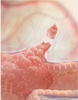 Lorsque les cellules quittent la tumeur primaire, elles ne répondent souvent plus aux médicaments qui ont initialement fonctionné (Visuel Fotolia)