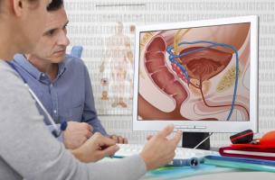 De nouveaux indices génétiques lient la lipoprotéine A au risque de cancer de la prostate (Visuel Adobe Stock 111509561). Darryl Leja, National Human Genome Research Institute, Flickr, CC BY 2.0 (https://creativecommons.org/licenses/by/2.0/) De nouveaux indices génétiques lient la lipoprotéine A au risque de cancer de la prostate (Visuel Adobe Stock 111509561). Darryl Leja, National Human Genome Research Institute, Flickr, CC BY 2.0 (https://creativecommons.org/licenses/by/2.0/)