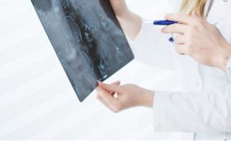 Des particules magnétiques utilisées pour chauffer et éliminer la tumeur, c’est le principe de l’hyperthermie magnétique, une technique émergente dans le traitement des cancers (Visuel Adobe Stock) Des particules magnétiques utilisées pour chauffer et éliminer la tumeur, c’est le principe de l’hyperthermie magnétique, une technique émergente dans le traitement des cancers (Visuel Adobe Stock)