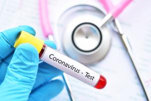 plus de 10% des patients seraient infectés par une personne infectée mais asymptomatique. plus de 10% des patients seraient infectés par une personne infectée mais asymptomatique.