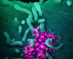 Un premier candidat vaccin devrait être testé dans les semaines à venir et les US National Institues of Health débutent les essais cliniques sur un médicament possible, le remdesivir. Un premier candidat vaccin devrait être testé dans les semaines à venir et les US National Institues of Health débutent les essais cliniques sur un médicament possible, le remdesivir.