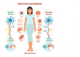 Il va être possible de développer de nouvelles thérapies géniques pour réparer la myéline