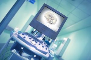 L’utilisation du cadre « PRIMERS » va permettre d’accélérer les progrès thérapeutiques en intégrant des contributions de la neuroscience, de la neurophysiologie et de la neuroréhabilitation L’utilisation du cadre « PRIMERS » va permettre d’accélérer les progrès thérapeutiques en intégrant des contributions de la neuroscience, de la neurophysiologie et de la neuroréhabilitation