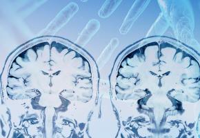 Une protéine, Fer2, semble jouer un rôle protecteur contre la maladie (Visuel Adobe Stock 241817004) Une protéine, Fer2, semble jouer un rôle protecteur contre la maladie (Visuel Adobe Stock 241817004)