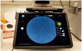 Ces toutes dernières techniques de séquençage d'ARN monocellulaire permettent de mieux comprendre les infections virales. Ces toutes dernières techniques de séquençage d'ARN monocellulaire permettent de mieux comprendre les infections virales.