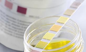 L'objectif est de traiter efficacement l’infection urinaire, souvent récurrente sans recours systématique et répété aux antibiotiques, prévenir dans le même temps la résistance aux antibiotiques (Visuel Fotolia)