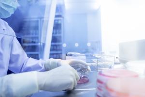 Cette recherche s’attache à décrypter les mécanismes par lesquels un type courant de bactérie, Staphylococcus aureus, s'adapte aux conditions de vie sur le corps humain, y compris aux conditions qui visent à l’éliminer (Visuel Adobe Stock 320678643) Cette recherche s’attache à décrypter les mécanismes par lesquels un type courant de bactérie, Staphylococcus aureus, s'adapte aux conditions de vie sur le corps humain, y compris aux conditions qui visent à l’éliminer (Visuel Adobe Stock 320678643)