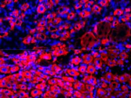 Un effet anti-âge par dilution du plasma sanguin ? (Visuel Irina Conboy) Un effet anti-âge par dilution du plasma sanguin ? (Visuel Irina Conboy)