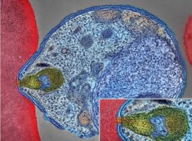 Le moustique injecte les parasites sous forme de sporozoïtes dans la peau et la circulation sanguine (Visuel montrant un parasite du paludisme se fixant à un globule rouge humain) (Visuel NIAID) Le moustique injecte les parasites sous forme de sporozoïtes dans la peau et la circulation sanguine (Visuel montrant un parasite du paludisme se fixant à un globule rouge humain) (Visuel NIAID)