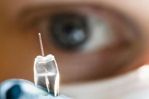 Cette pompe à ions peut délivrer des cytostatiques avec plus de précision dans le cerveau, avec donc moins effets indésirables (Visuel Thor Balkhed) Cette pompe à ions peut délivrer des cytostatiques avec plus de précision dans le cerveau, avec donc moins effets indésirables (Visuel Thor Balkhed).