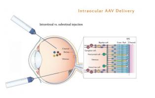 Environ 170 millions de personnes dans le monde souffrent de dégénérescence maculaire liée à l'âge (DMLA). La DMLA touche une personne sur 10 de plus de 55 ans. Environ 170 millions de personnes dans le monde souffrent de dégénérescence maculaire liée à l'âge (DMLA). La DMLA touche une personne sur 10 de plus de 55 ans.