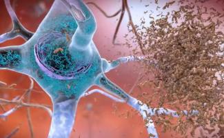 Il existe une corrélation entre certaines espèces de bactéries et la présence des agrégats toxiques caractéristiques de ces maladies neurodégénératives (Visuel NIH) Il existe une corrélation entre certaines espèces de bactéries et la présence des agrégats toxiques caractéristiques de ces maladies neurodégénératives (Visuel NIH)