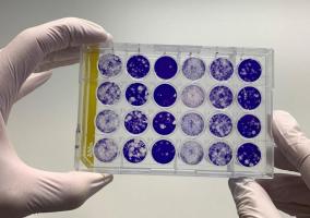 COVID : Seule une toute petite proportion de la population semble avoir développé des anticorps au cours de la première vague épidémique (Visuel Fotolia) COVID : Seule une toute petite proportion de la population semble avoir développé des anticorps au cours de la première vague épidémique (Visuel Fotolia)