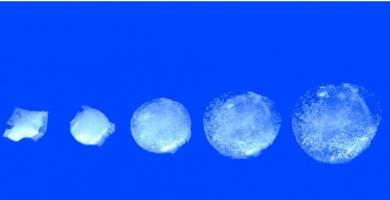 La pilule gonflable comprend un capteur qui surveille en continu la température de l'estomac pendant 30 jours. 