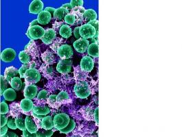 La combinaison triclosanassocié à l’antibiotique tobramycine élimine les cellules qui protègent la bactérie Pseudomonas aeruginosa, jusqu'à 99,9%. 