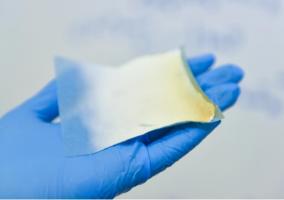 Parmi les progrès de traitement des brûlures, l’excision précoce et les greffes de peau ou de substituts cutanés (visuel) rapidement après la brûlure. Parmi les progrès de traitement des brûlures, l’excision précoce et les greffes de peau ou de substituts cutanés (visuel) rapidement après la brûlure.