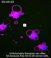 La CICD conduit à l'éradication complète des tumeurs, ici dans les modèles expérimentaux La CICD conduit à l'éradication complète des tumeurs, ici dans les modèles expérimentaux